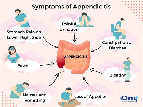 What Causes Frequent Appendicitis